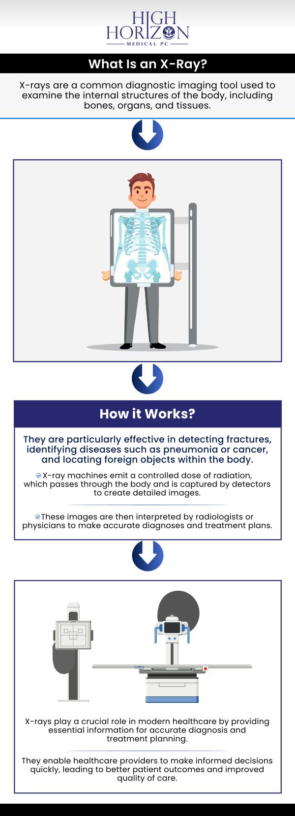 At High Horizon Medical PC, X-rays are an essential tool for the early detection of various medical conditions. Dr. Ali Tabarroki and our team use advanced X-ray technology to identify issues such as fractures, infections, tumors, and heart or lung diseases at their earliest stages. By providing clear and detailed images of the inside of the body, X-rays help doctors detect abnormalities before symptoms become severe. For more information, contact us or schedule an appointment online. We are conveniently located at 396 Hempstead Avenue, West Hempstead, NY 11552. At High Horizon Medical PC, X-rays are an essential tool for the early detection of various medical conditions. Dr. Ali Tabarroki and our team use advanced X-ray technology to identify issues such as fractures, infections, tumors, and heart or lung diseases at their earliest stages. By providing clear and detailed images of the inside of the body, X-rays help doctors detect abnormalities before symptoms become severe. For more information, contact us or schedule an appointment online. We are conveniently located at 396 Hempstead Avenue, West Hempstead, NY 11552.
